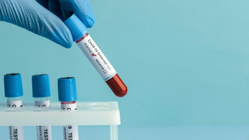 Blood Test