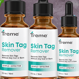 Treme Remover