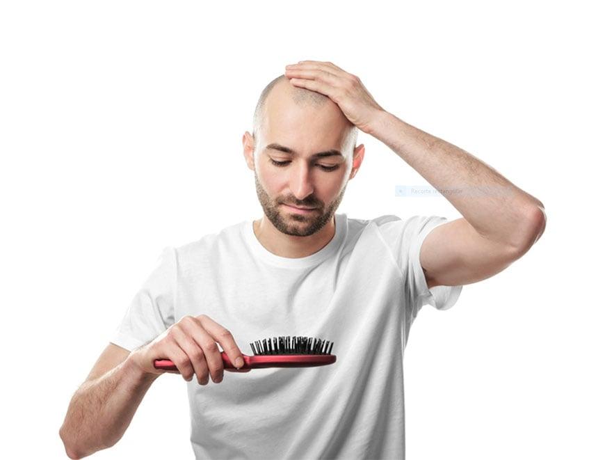 Hair transplant in Dubai