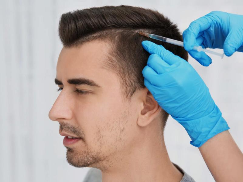 Hair transplant in Dubai