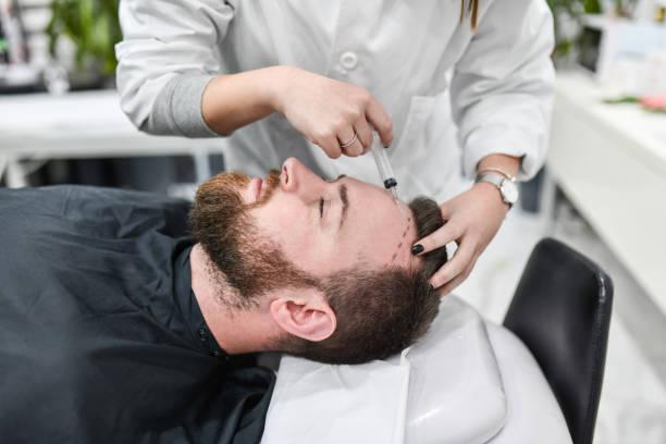 Hair Transplant in Dubai