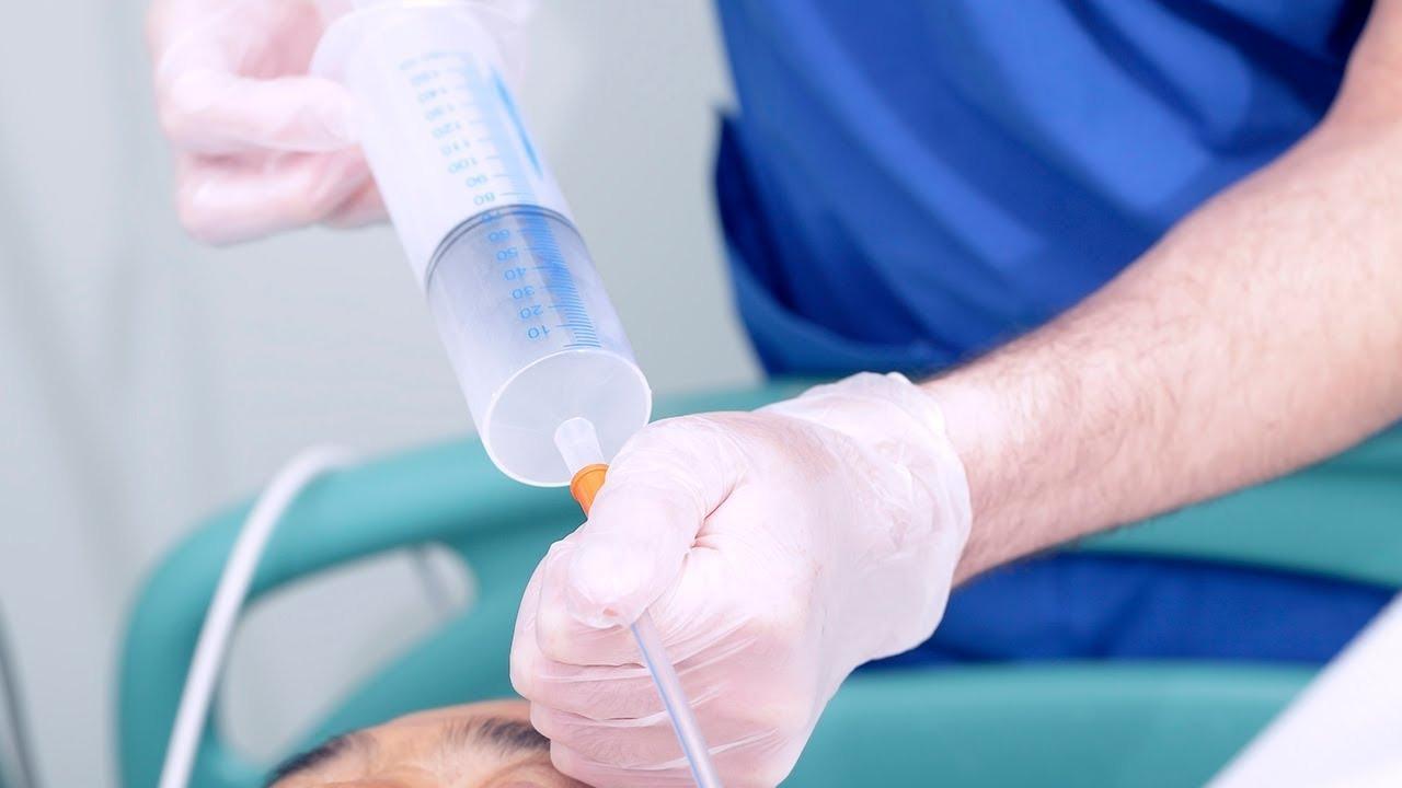 Tube Feeding at home