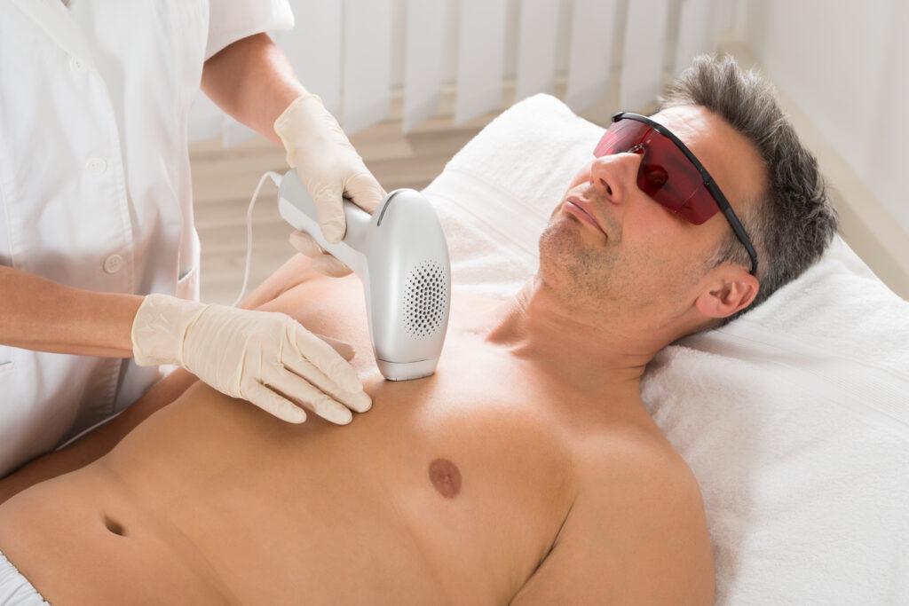 Male Laser Hair Removal