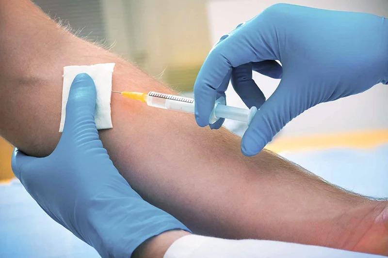 Hepatitis C Test