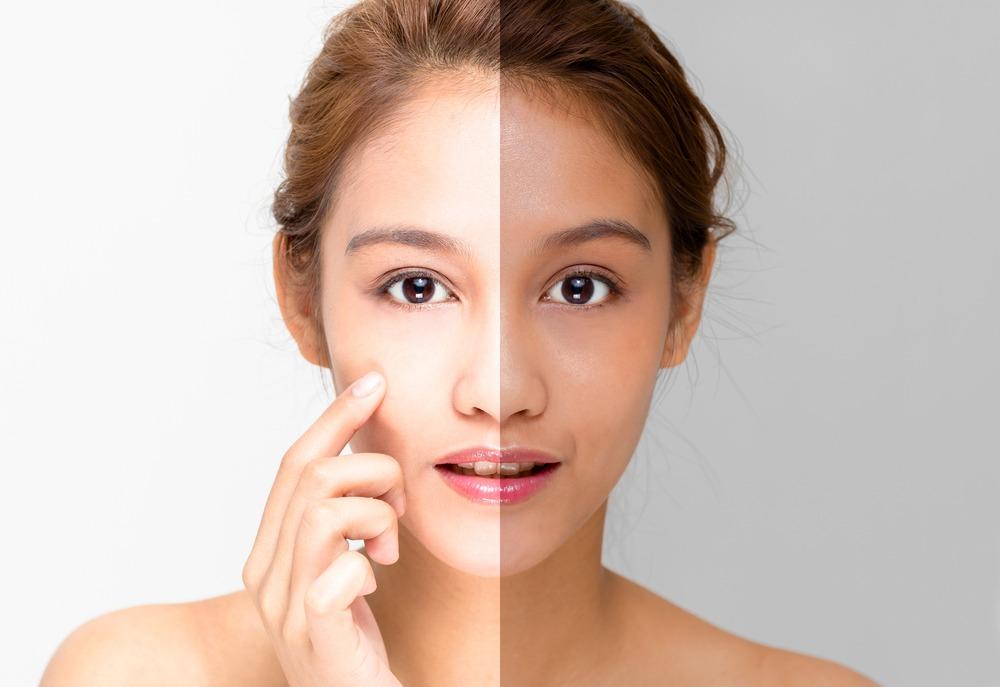 Permanent Skin Whitening Injection