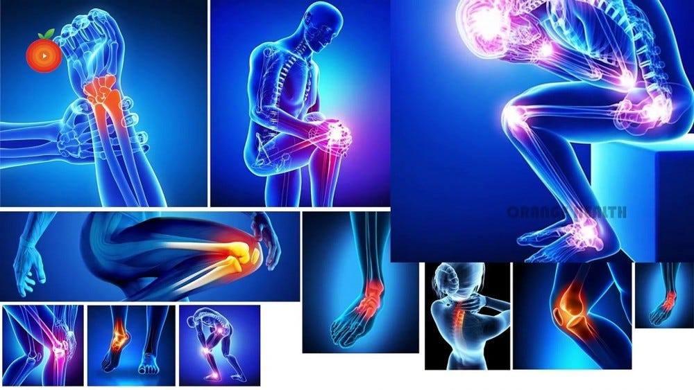 Arthro Max