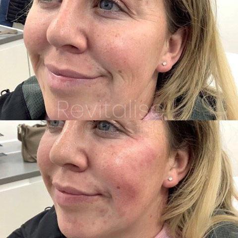 Halcyon MediSpa