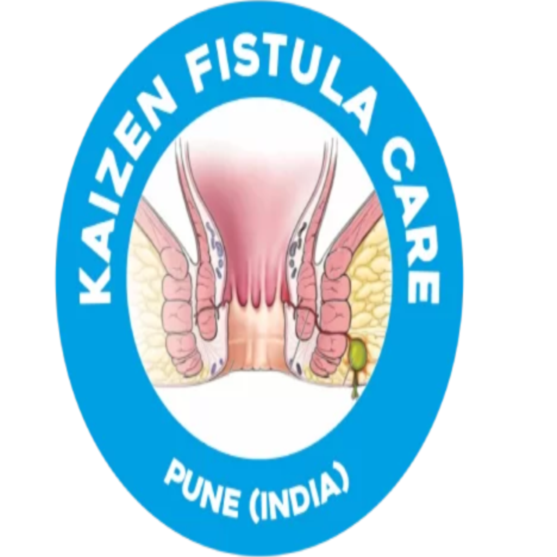 Kaizen Fistula Care