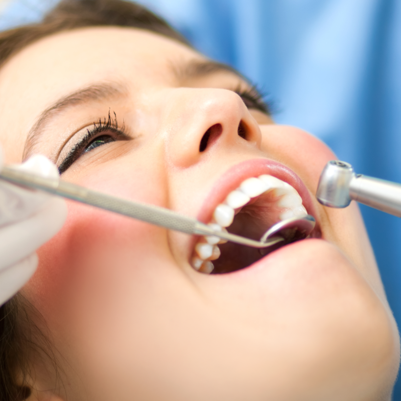 Westvan Couverdental