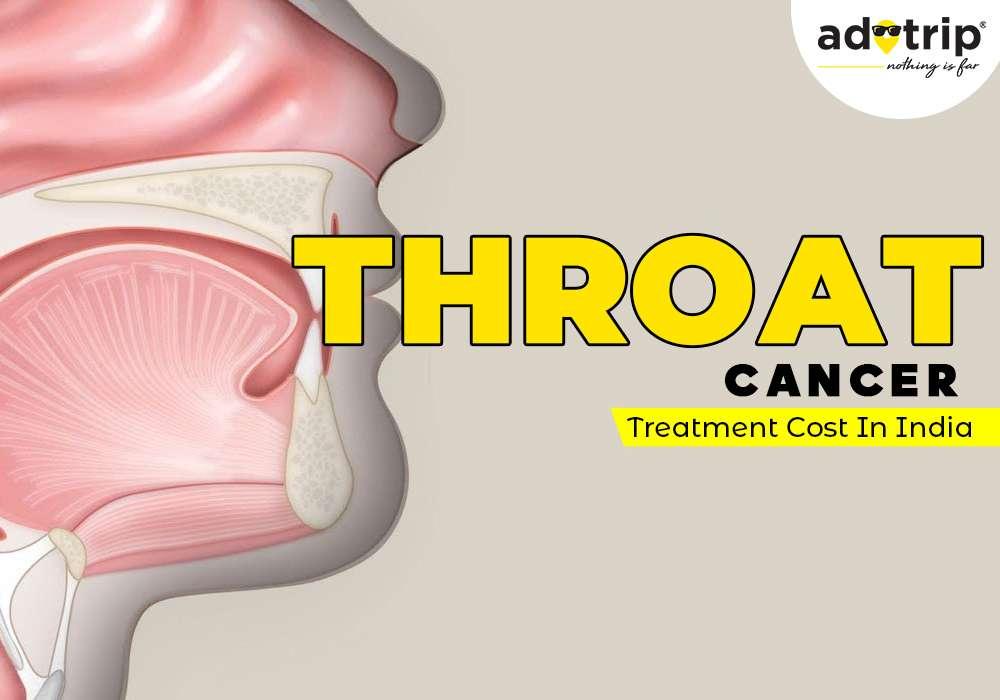 Understanding The Cost Of Throat Cancer Treatment In India